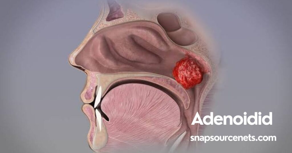 Adenoidid